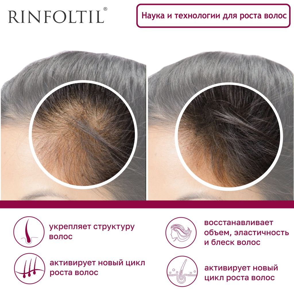 Rinfoltil Сыворотка для ослабленных и истонченных волос, липосомальная сыворотка, 30 шт.